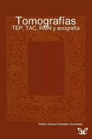 Tomografías - TEP, TAC, RMN y ecografía